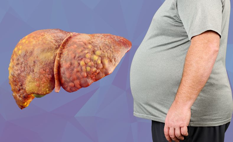 क्या आपकी लाइफस्टाइल बना रही है आपको फैटी लिवर का शिकार? युवाओं में दिख रहे ये खतरनाक संकेत