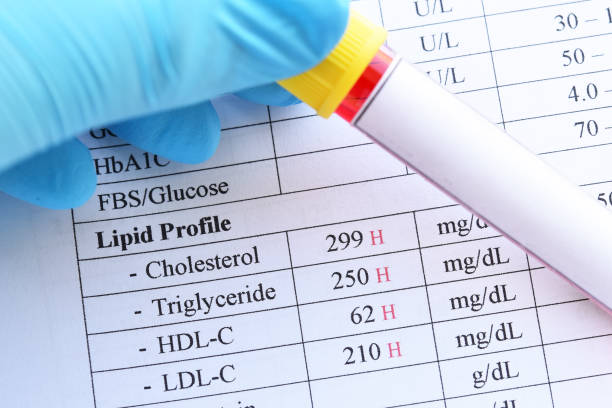 लिपिड प्रोफाइल रिपोर्ट का सही मतलब समझें: दिल की सेहत के लिए हर नंबर है अहम