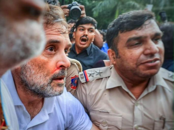 PM आवास मार्च के दौरान राहुल गांधी घायल, नाक से खून बहने की तस्वीर वायरल; कांग्रेस ने पुलिस कार्रवाई पर उठाए सवाल PM आवास मार्च के दौरान राहुल गांधी घायल, नाक से खून बहने की तस्वीर वायरल; कांग्रेस ने पुलिस कार्रवाई पर उठाए सवाल